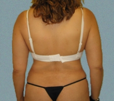 patient9_after