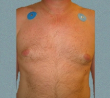 patient6_after1_4months