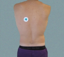 patient10_before2